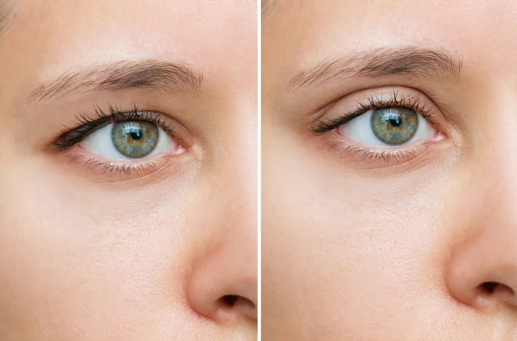 Schlupflider: Was kann man tun und welche Make-up-Techniken sind hilfreich?