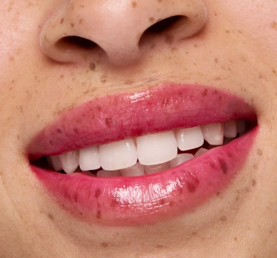 Essence Juicy Melon Lippen- und Wangenbalsam 3 g