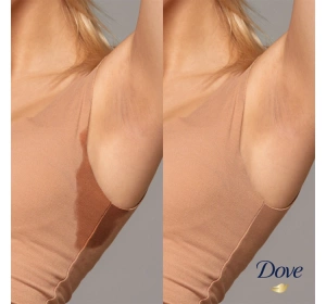 Dove Original Advanced Care Antitranspirant Roll-on 50ml