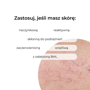 Veoli Botanica Intense Redness Defense Nährend-stärkende reichhaltige Creme für empfindliche Haut 30 ml