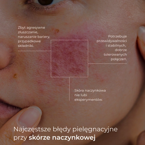 Kliknij na zdjęcie, aby je powiększyć Veoli Botanica Redness Harmony Beruhigend-stärkende leichte Creme für empfindliche Haut 30 ml